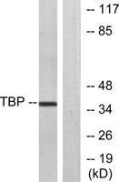 TFIID Polyclonal Antibody