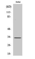 TFIIE-β Polyclonal Antibody