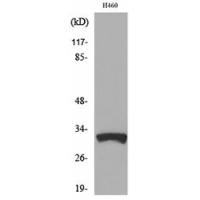 TFPI-2 Polyclonal Antibody