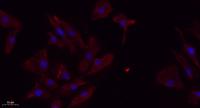 TGFβ RII Polyclonal Antibody
