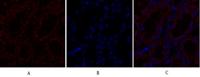 TGFβ RII Polyclonal Antibody