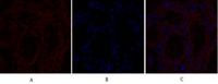 TGFβ RII Polyclonal Antibody
