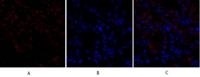 TGFβ RII Polyclonal Antibody