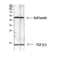 TGFβ2 Polyclonal Antibody