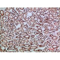 TGFβ2 Polyclonal Antibody