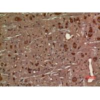 Fractalkine Receptor Polyclonal Antibody