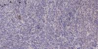 THP Polyclonal Antibody