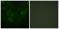 Thymidine Kinase Polyclonal Antibody