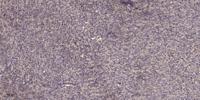 TBL2 Polyclonal Antibody