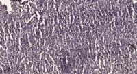 TBX2 Polyclonal Antibody