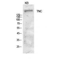 Tenascin-C Polyclonal Antibody