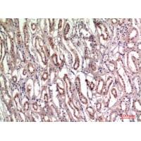 Tenascin-C Polyclonal Antibody