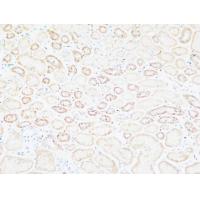 Tenascin-C Polyclonal Antibody