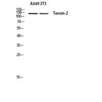 Tensin-2 Polyclonal Antibody