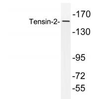 Tensin-2 Polyclonal Antibody