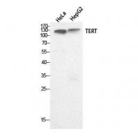 TERT Polyclonal Antibody