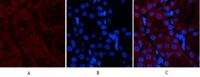 Tak1 Polyclonal Antibody