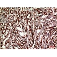 Talin-1 Polyclonal Antibody