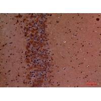 Talin-1 Polyclonal Antibody