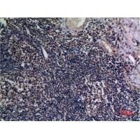 TALL-1 Polyclonal Antibody