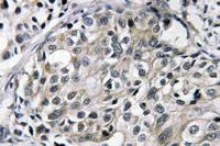TAT Polyclonal Antibody