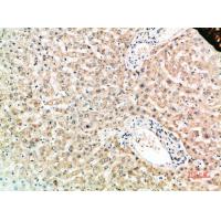 RANK Polyclonal Antibody