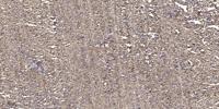 PKAβ Polyclonal Antibody