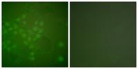 Rad17 Polyclonal Antibody