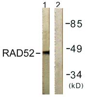 Rad52 Polyclonal Antibody