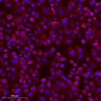 Radixin Polyclonal Antibody