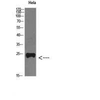 PTH-rP Polyclonal Antibody