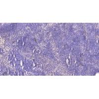 PTH-rP Polyclonal Antibody
