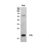 PTN Polyclonal Antibody