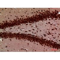 PTN Polyclonal Antibody