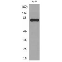 PKC γ Polyclonal Antibody