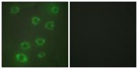 Ptx3 Polyclonal Antibody
