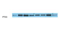 Ptx3 Polyclonal Antibody
