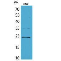 Rab 5A Polyclonal Antibody