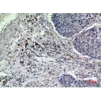 Rab 5A Polyclonal Antibody