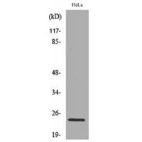 Rab 5A Polyclonal Antibody