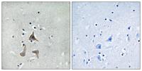 RGR Polyclonal Antibody