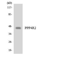 PP4R2 Polyclonal Antibody