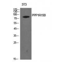 PPP1R15B Polyclonal Antibody
