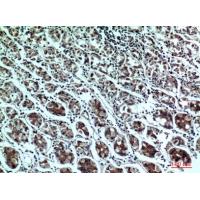 PPP1R15B Polyclonal Antibody