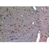 PREP Polyclonal Antibody