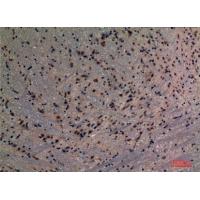 PREP Polyclonal Antibody
