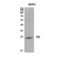 Prolactin Polyclonal Antibody