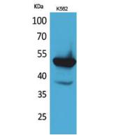 Protein C Polyclonal Antibody