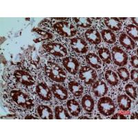 Protein C Polyclonal Antibody
