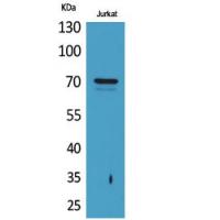 Prothrombin Polyclonal Antibody